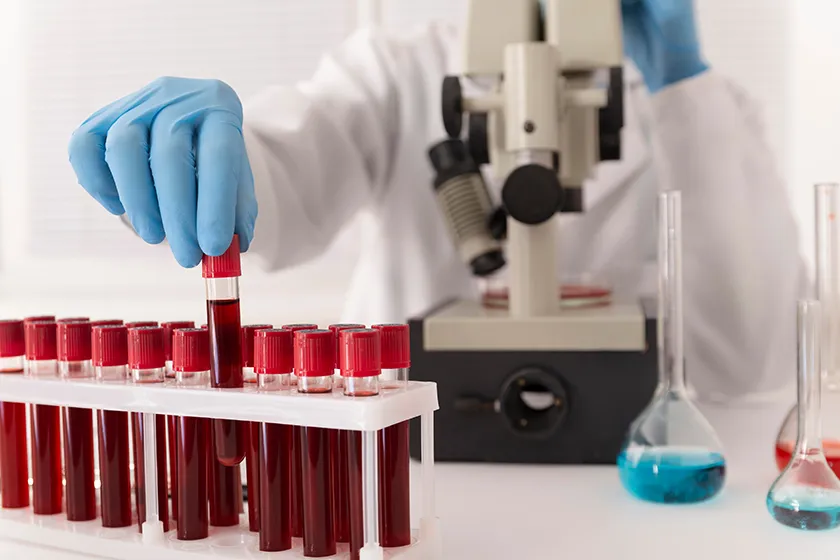 blood test process